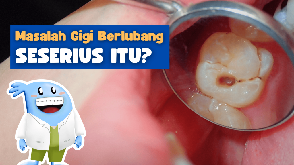 foto dokter memeriksa gigi geraham berlubang dengan cermin gigi