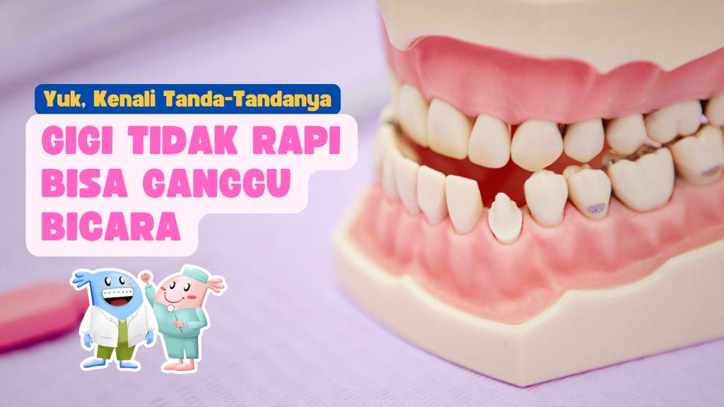 Gambar model gigi tidak rapi sebagai ilustrasi dampak maloklusi terhadap gangguan bicara anak