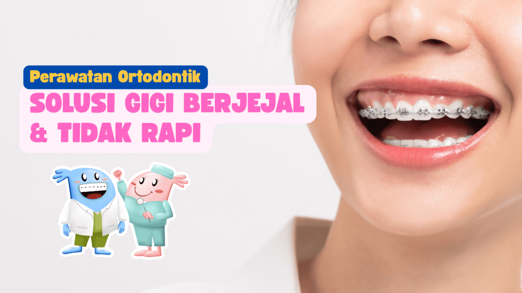 Perawatan ortodontik solusi gigi berjejal dan tidak rapi dengan behel di Klinik Gigi Dentes