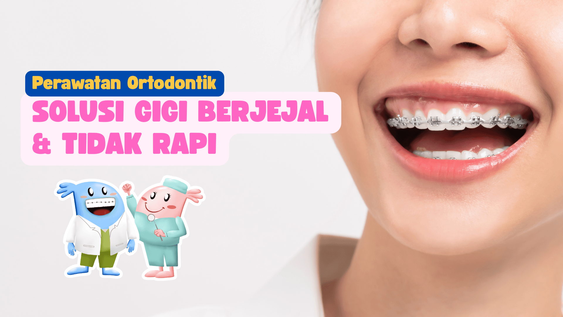 Perawatan ortodontik solusi gigi berjejal dan tidak rapi dengan behel di Klinik Gigi Dentes